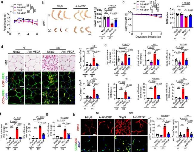 UCP1 Antibody in Immunohistochemistry (IHC)