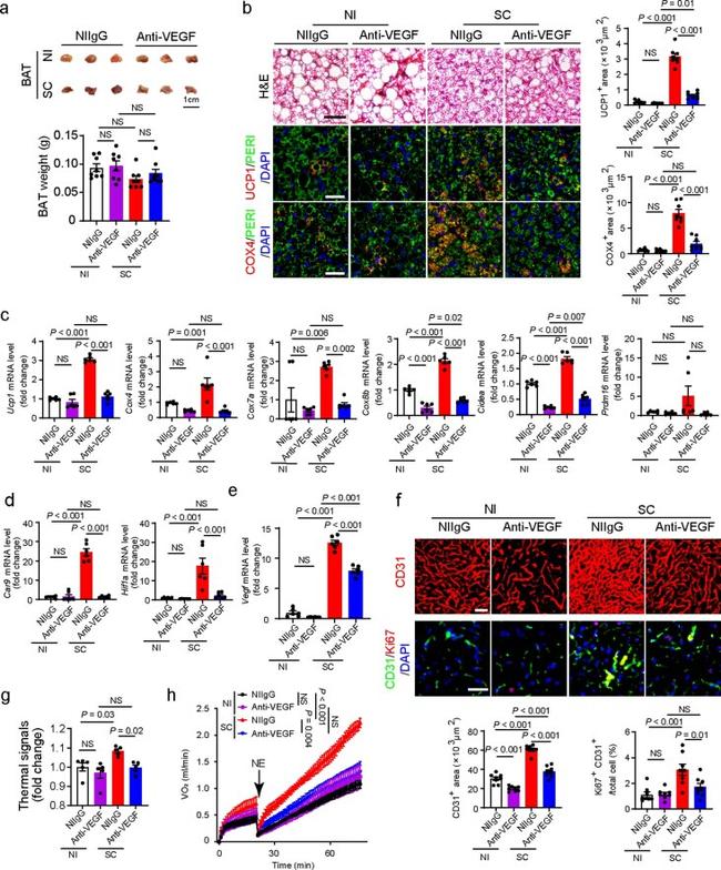 UCP1 Antibody in Immunohistochemistry (IHC)