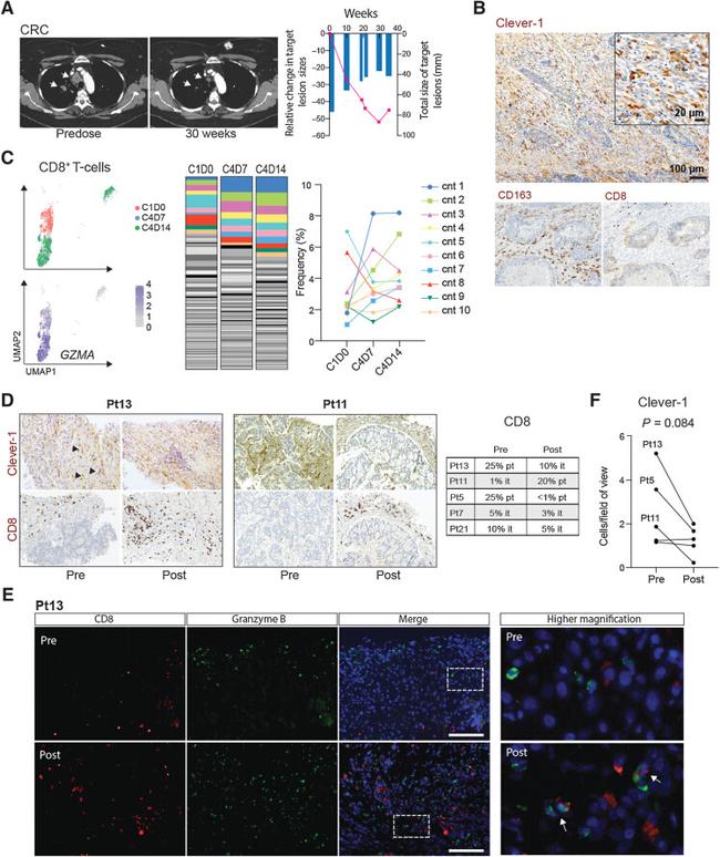 Granzyme B Antibody in Immunohistochemistry (IHC)