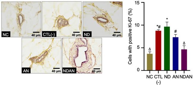 Caspase 3 Antibody in Immunohistochemistry (IHC)