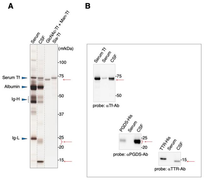 PTGDS Antibody in Western Blot (WB)