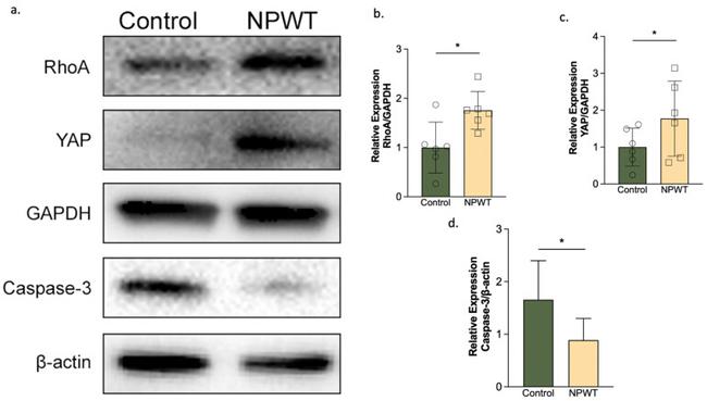 YAP1 Antibody in Western Blot (WB)