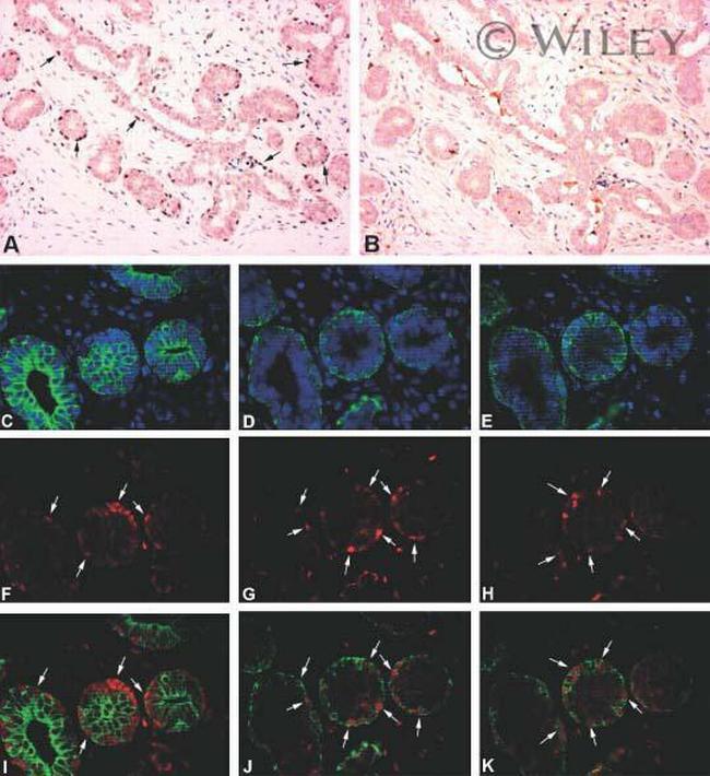 Glucocorticoid Receptor Antibody in Immunohistochemistry (IHC)