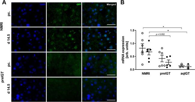 PPAR alpha Antibody in Immunohistochemistry (IHC)