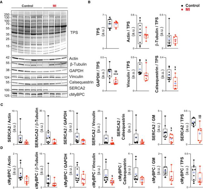 Calsequestrin Antibody in Western Blot (WB)