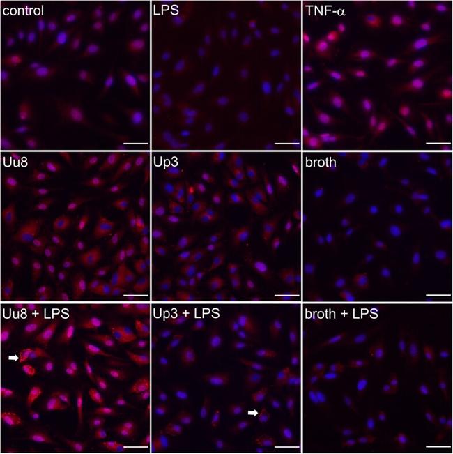 CXCR7 Antibody in Immunocytochemistry (ICC/IF)