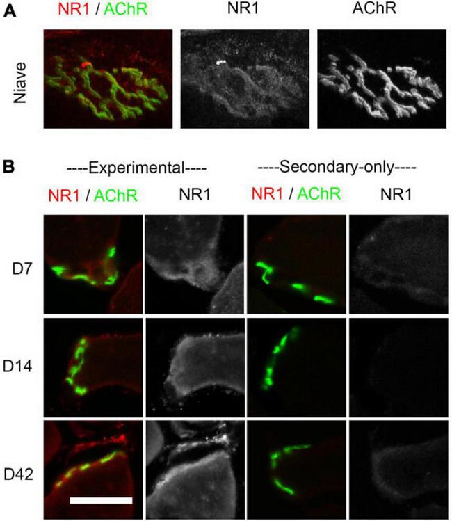 NMDAR1 Antibody in Immunohistochemistry (IHC)