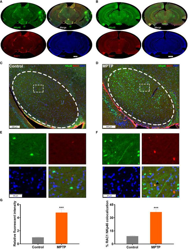 NKp46 Antibody in Immunohistochemistry (IHC)