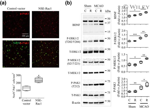 Phospho-PAK1 (Thr212) Antibody in Western Blot, Immunohistochemistry (WB, IHC)