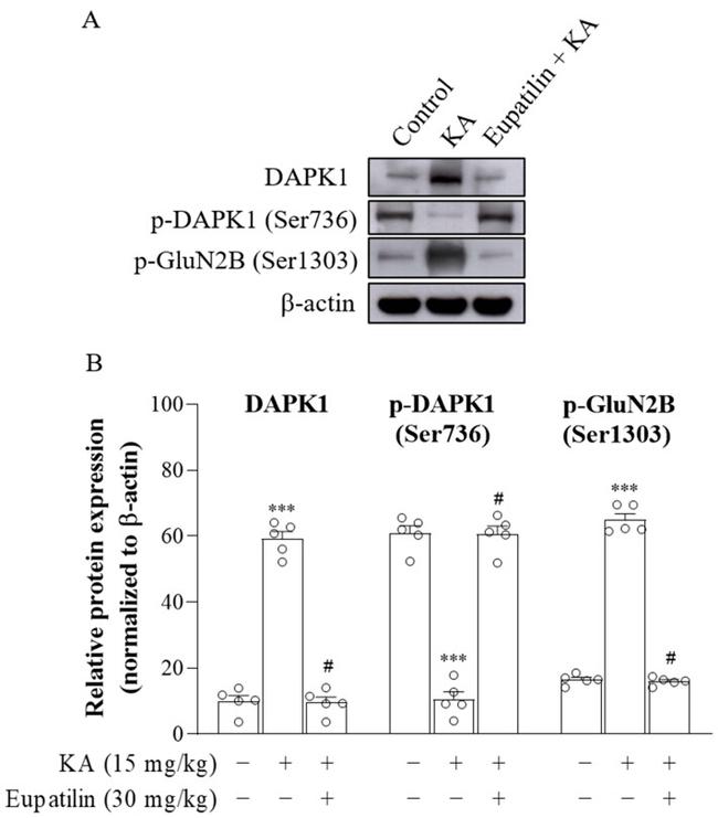 Phospho-DAPK1 (Ser734) Antibody in Western Blot (WB)