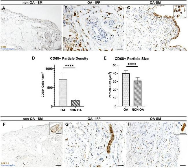 PGP9.5 Antibody in Immunohistochemistry (IHC)