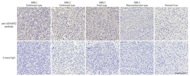 ADAM32 Antibody in Immunohistochemistry (IHC)