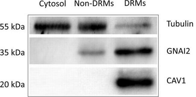 GNAI2 Antibody in Western Blot (WB)