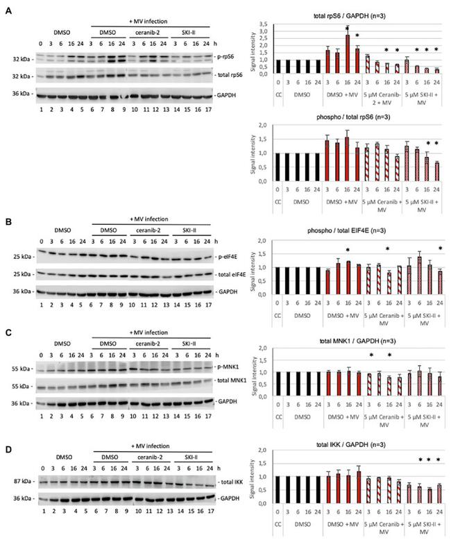 Phospho-MNK1 (Thr197, Thr202) Antibody in Western Blot (WB)