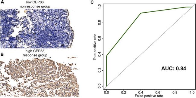 CEP83 Antibody in Immunohistochemistry (IHC)