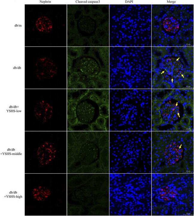 Caspase 3 (Cleaved Asp175) Antibody in Immunohistochemistry (IHC)