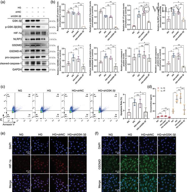 GSDMD Antibody in Western Blot, Immunocytochemistry (WB, ICC/IF)