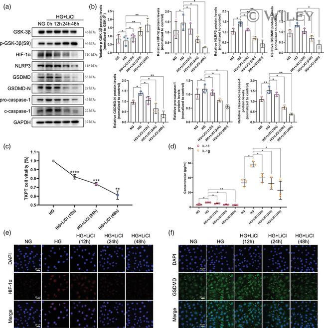 GSDMD Antibody in Immunocytochemistry (ICC/IF)