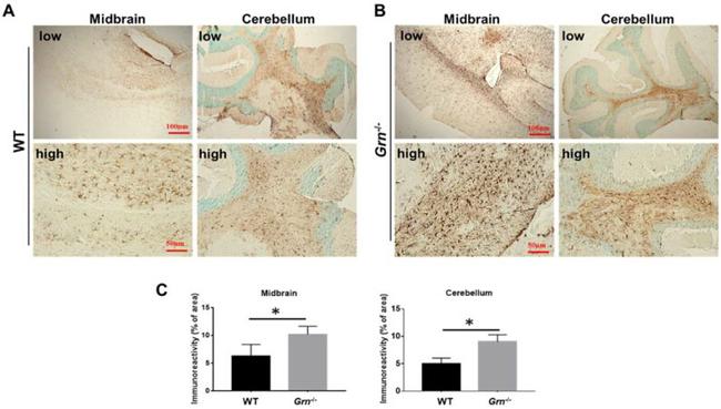 GFAP Antibody in Immunohistochemistry (IHC)