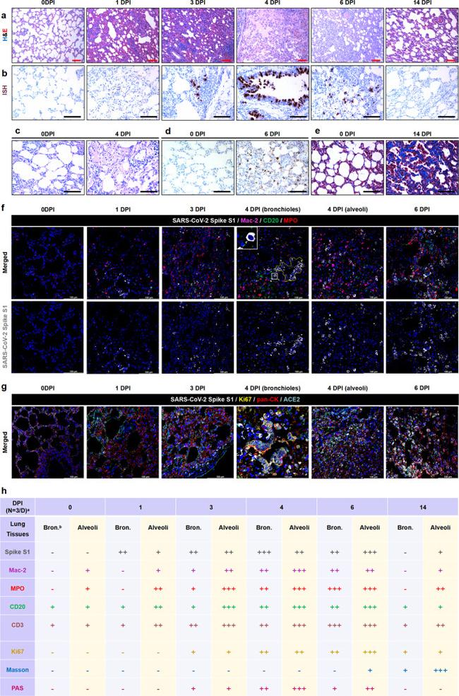 CD20 Antibody in Immunohistochemistry (IHC)