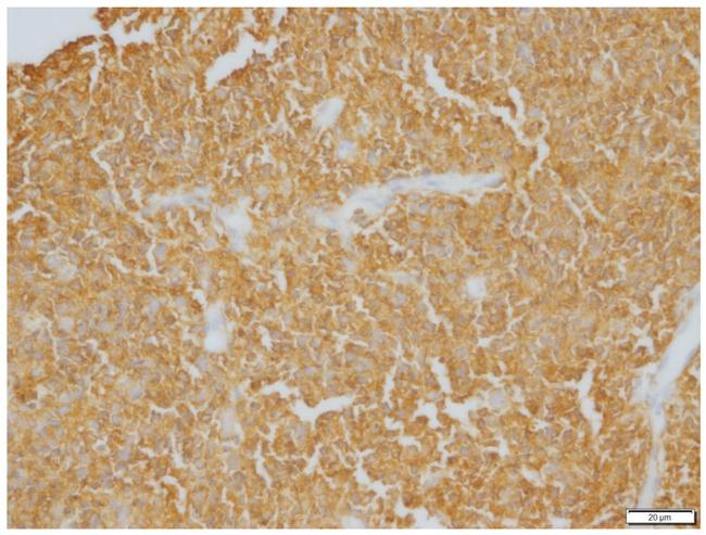 CD20 Antibody in Immunohistochemistry (IHC)