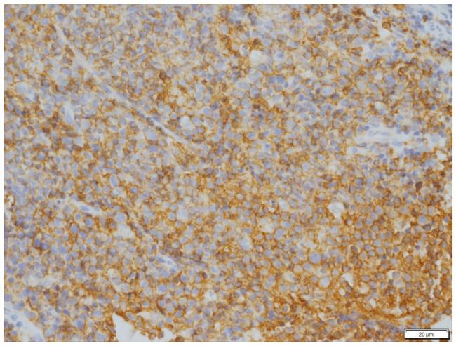 CD20 Antibody in Immunohistochemistry (IHC)