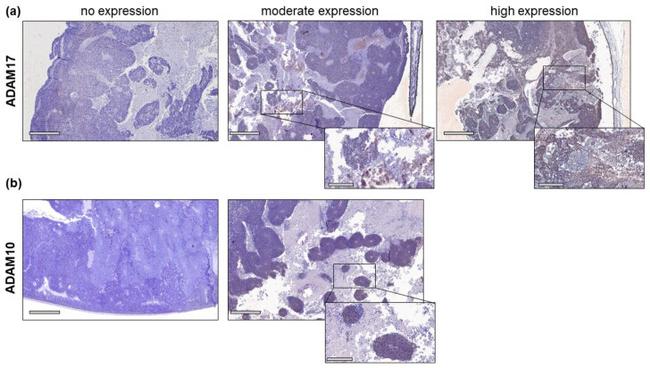 ADAM17 Antibody in Immunohistochemistry (IHC)