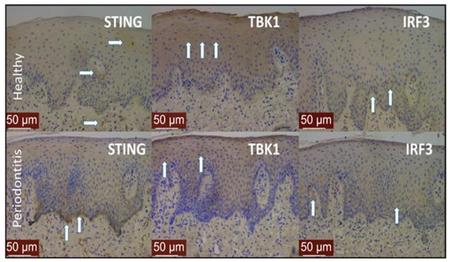 STING Antibody in Immunohistochemistry (IHC)