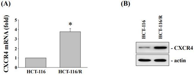 CXCR4 Antibody in Western Blot (WB)