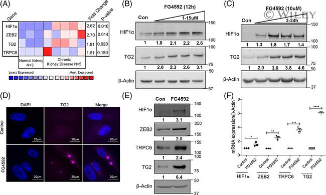 TRPC6 Antibody in Western Blot (WB)