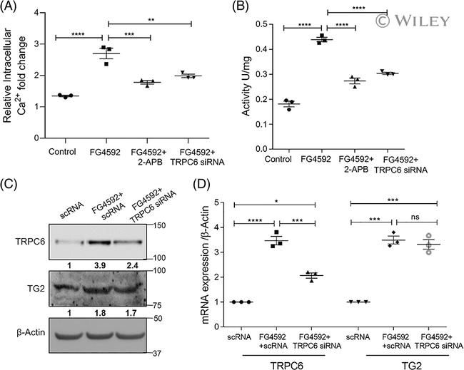 TRPC6 Antibody in Western Blot (WB)