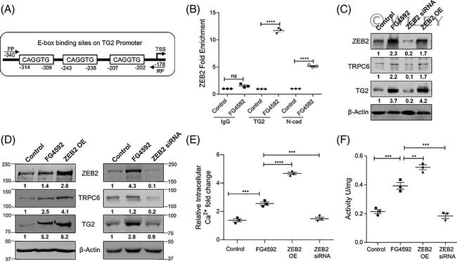 TRPC6 Antibody in Western Blot (WB)