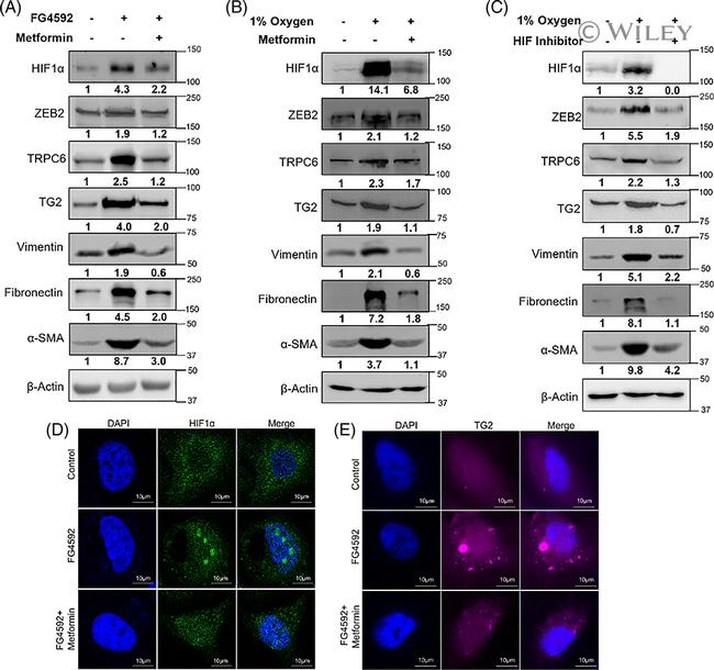 TRPC6 Antibody in Western Blot (WB)