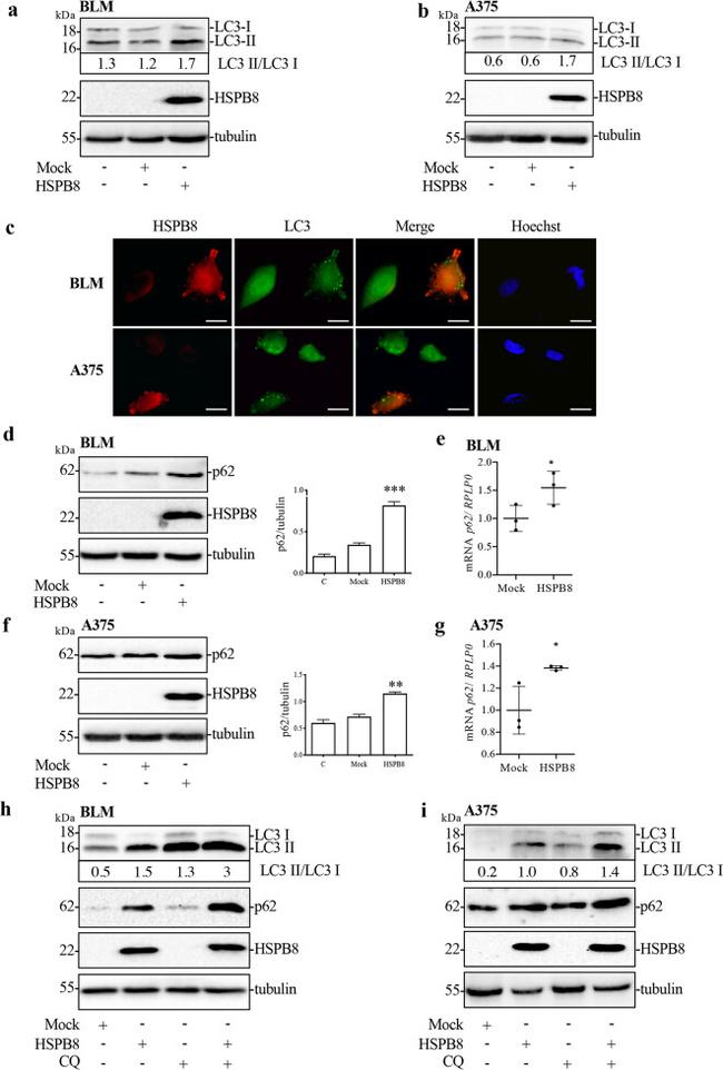 SQSTM1 Antibody in Western Blot (WB)