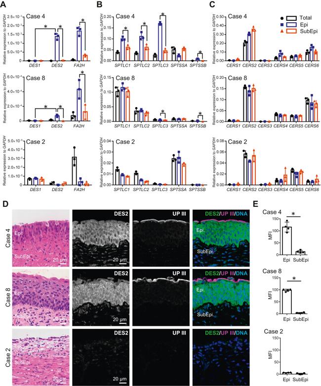 DEGS2 Antibody in Immunohistochemistry (IHC)