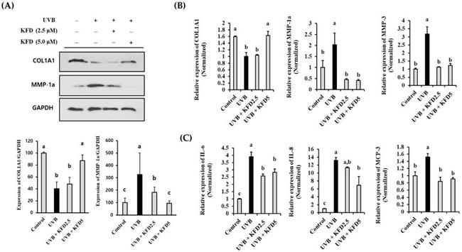 COL1A1 Antibody in Western Blot (WB)