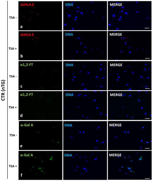 alpha Galactosidase Antibody in Immunocytochemistry (ICC/IF)