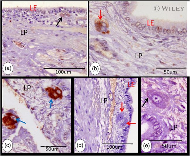 NSE Antibody in Immunohistochemistry (IHC)