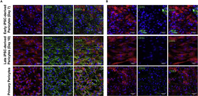 TAGLN Antibody in Immunocytochemistry (ICC/IF)