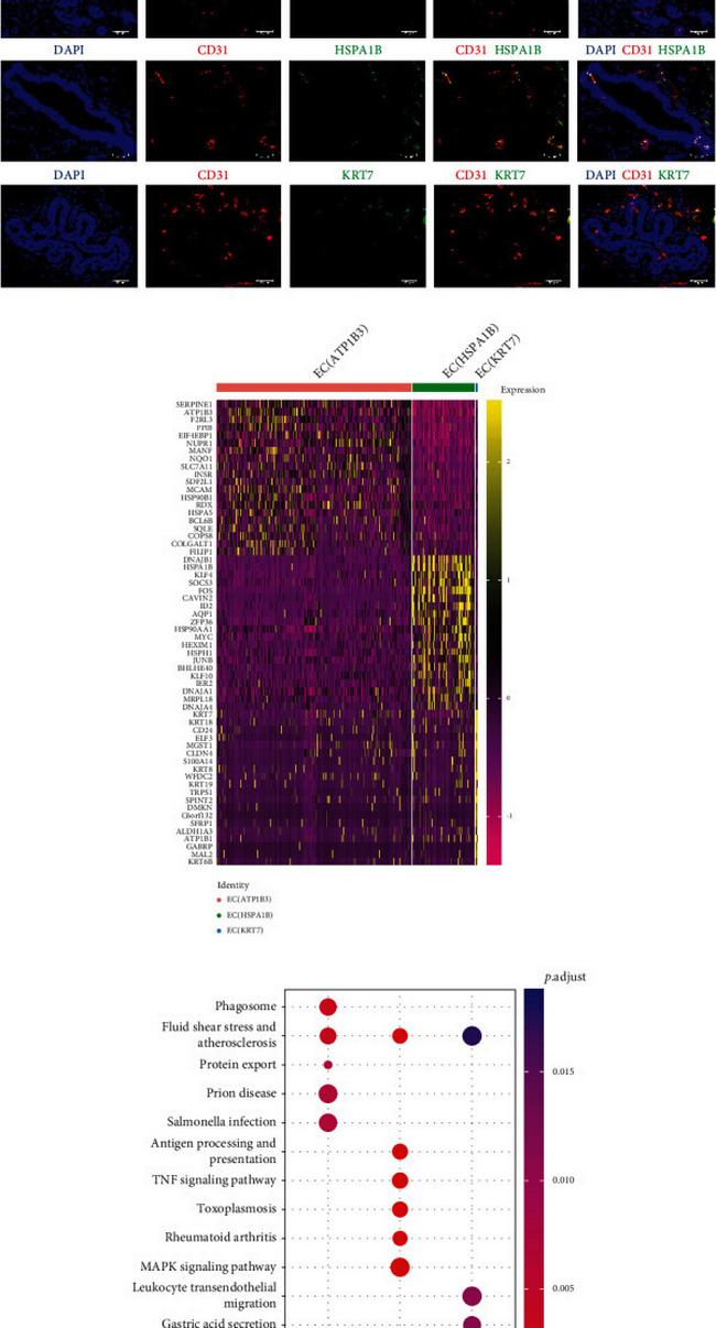 HSPA1B Antibody in Immunohistochemistry (IHC)