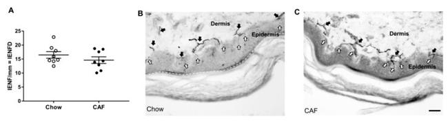 PGP9.5 Antibody in Immunohistochemistry (IHC)