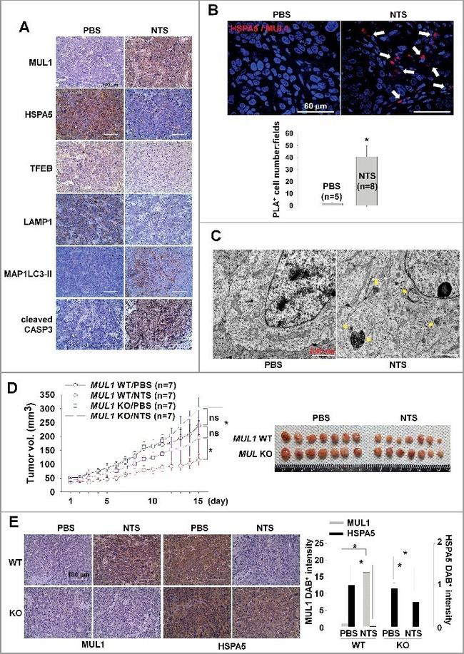 TFEB Antibody in Immunohistochemistry (IHC)