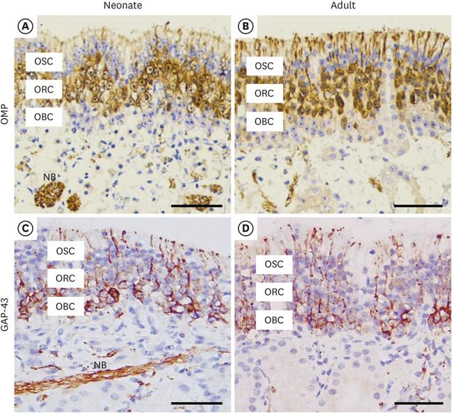 GAP43 Antibody in Immunohistochemistry (IHC)