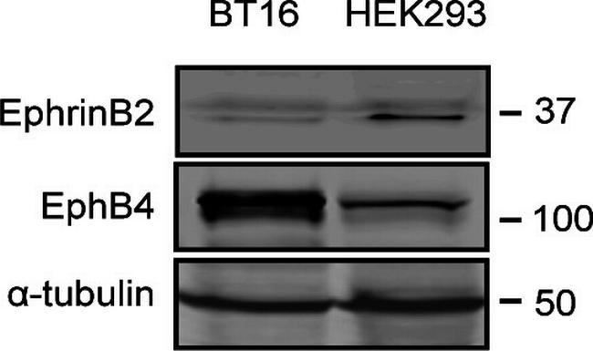 Ephrin B2 Antibody in Western Blot (WB)