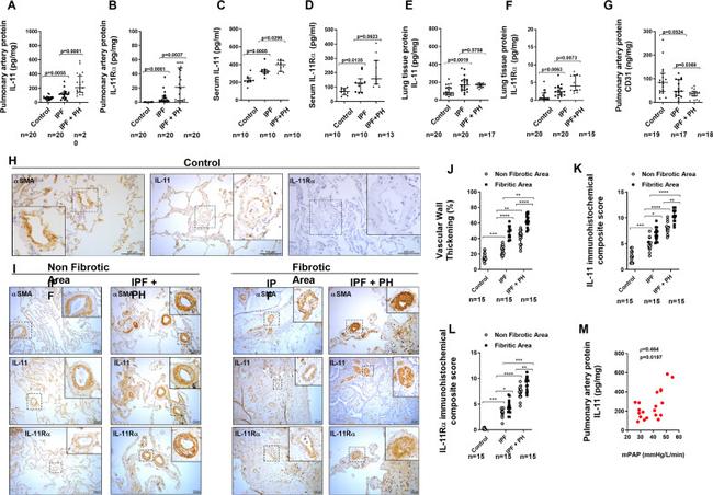 IL-11 Antibody in Immunohistochemistry (IHC)