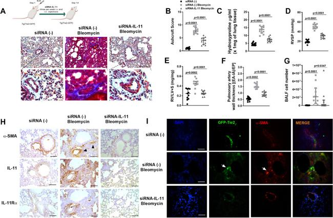 IL-11 Antibody in Immunohistochemistry (IHC)