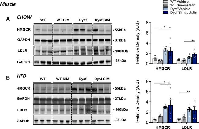 HMGCR Antibody in Western Blot (WB)