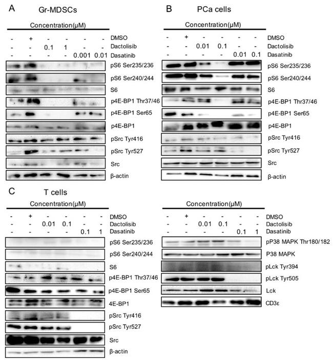 Phospho-LCK (Tyr394) Antibody in Western Blot (WB)