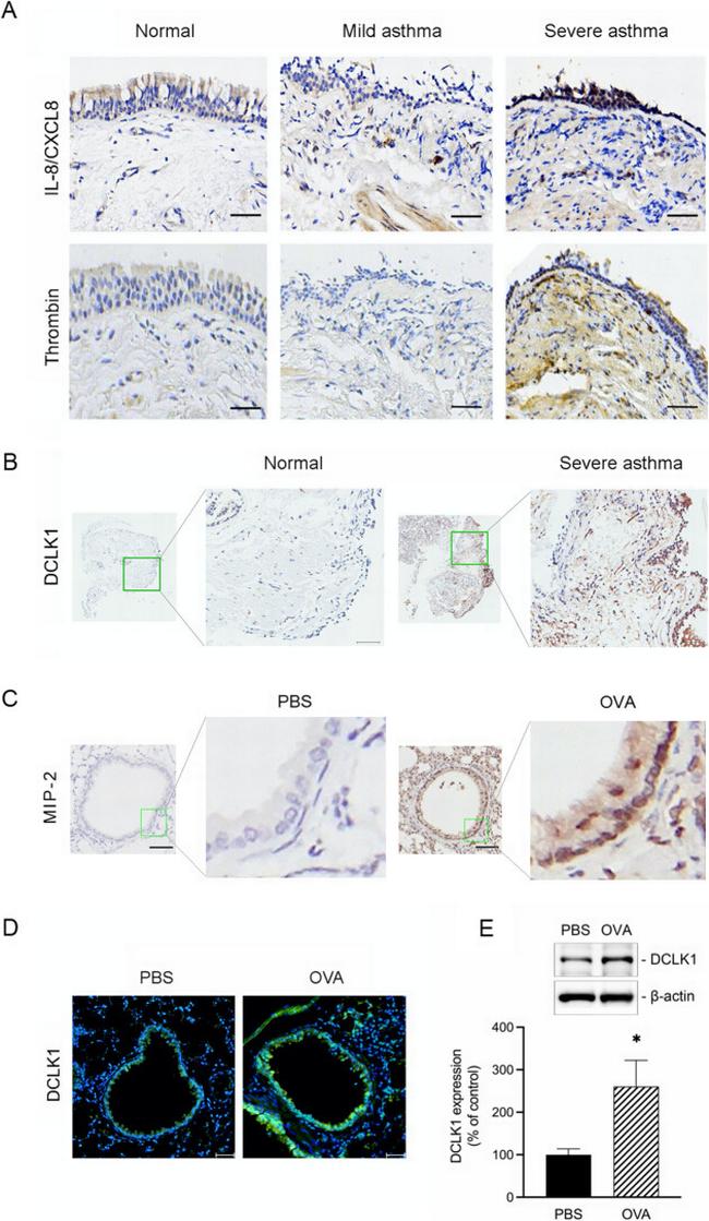 CXCL2 Antibody in Immunohistochemistry (IHC)