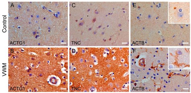 Glutamine Synthetase Antibody in Immunohistochemistry (IHC)